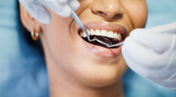 Best Emergency Dental Care for Sports Injuries in Canaan, CT